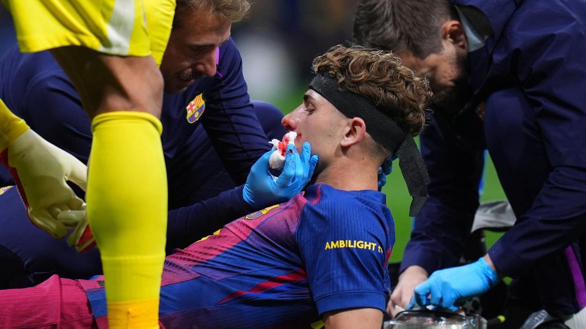 Fermín López'den Korkutan Sakatlık: Futbol Sahalarında Kafa Yaralanmaları Tartışması