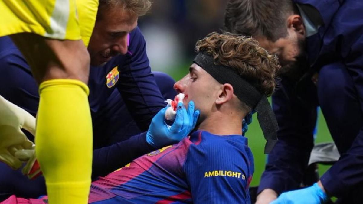 Fermín López'in Acı Dolu Sakatlığı: Şampiyonlar Ligi Vedası ve Yüzündeki Dikişler