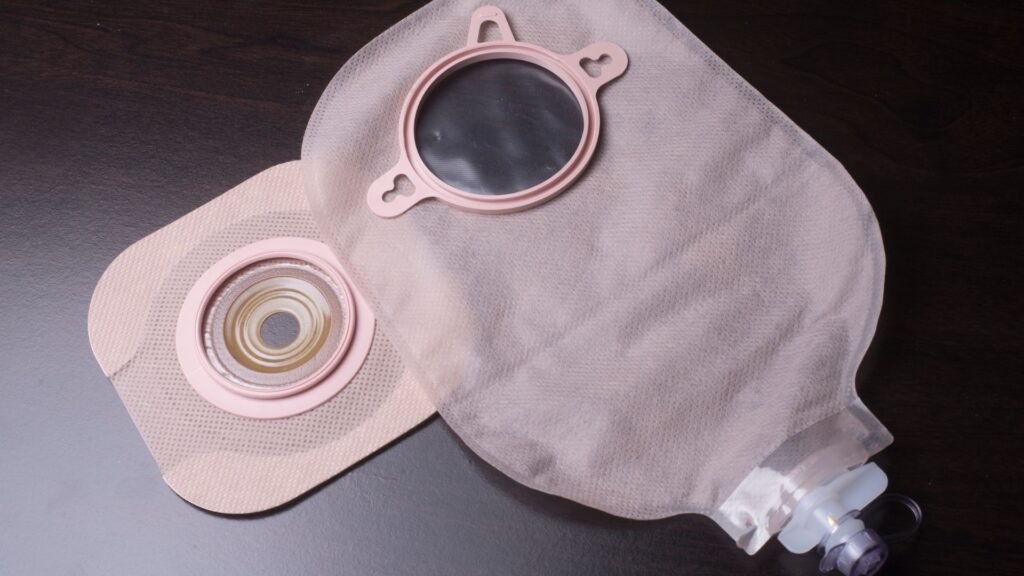Ostomi ile Yaşamak: Hayatı Değiştiren Cerrahi Girişim ve Destek Programları