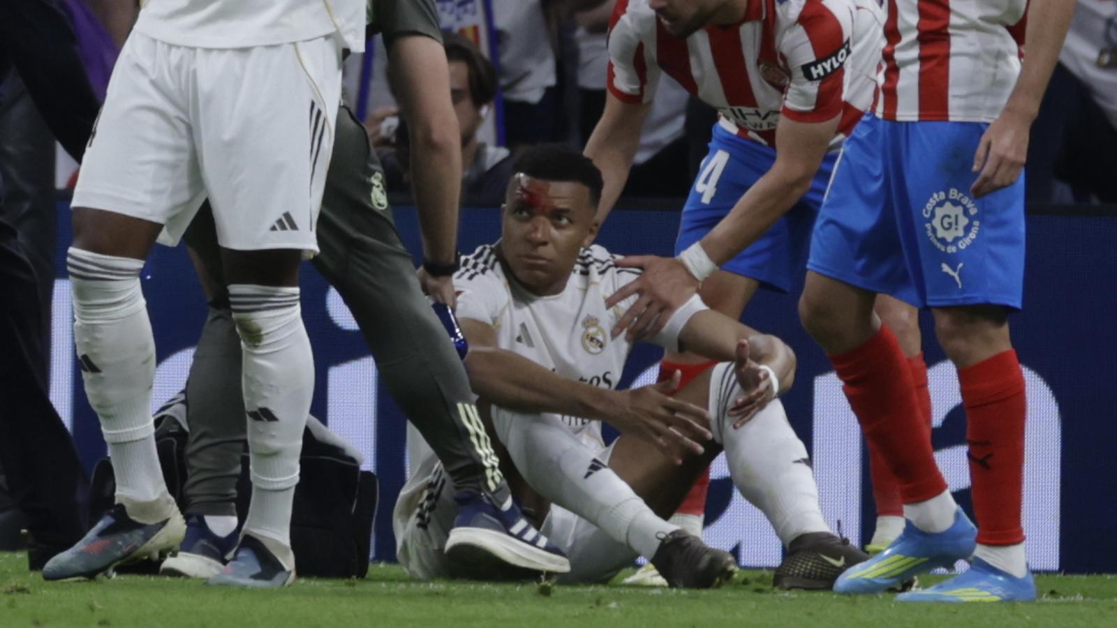 Mbappé Paradoksu: Real Madrid'deki Yıldızın Bireysel Parlaklığı Takım Başarısına Neden