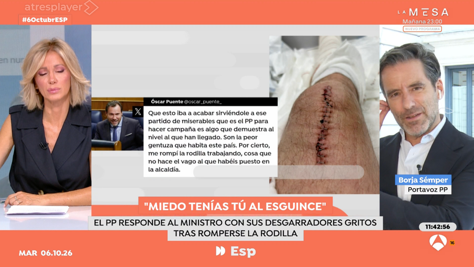 İspanyol Medyasında Siyasi Gerilim Tırmanıyor: "Hamster Çarkı" Eleştirisi