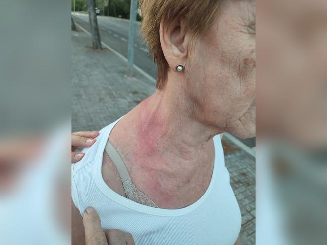 İspanya'da Yaşlı Kadınları Hedef Alan Şiddetli Soygunlarda Şüpheli Yakalandı