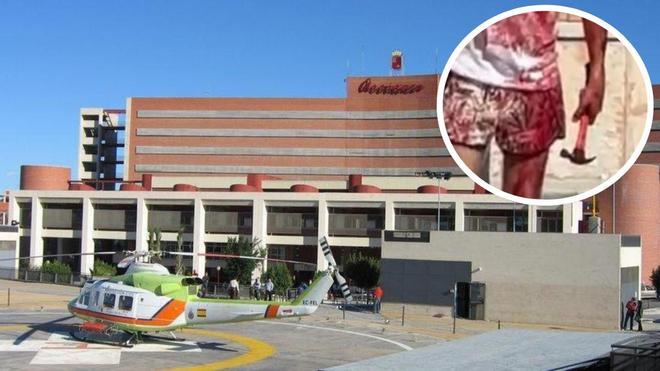 Murcia'da Çekiçli Saldırıya Uğrayan Adamın Yoğun Bakımdaki Yaşam Mücadelesi Sürüyor