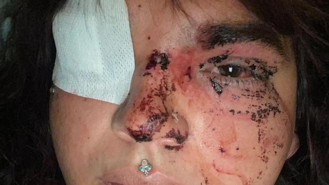 León'da Transfobik Saldırıya Uğrayan "Miss Trans Zamora": "Ayaktayım!"