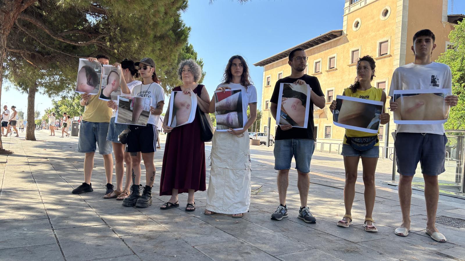 Palma'da Turizm Karşıtı Protestoda Şiddet İddiası: 25 Kişi Ulusal Polisi Mahkemeye Veriyor
