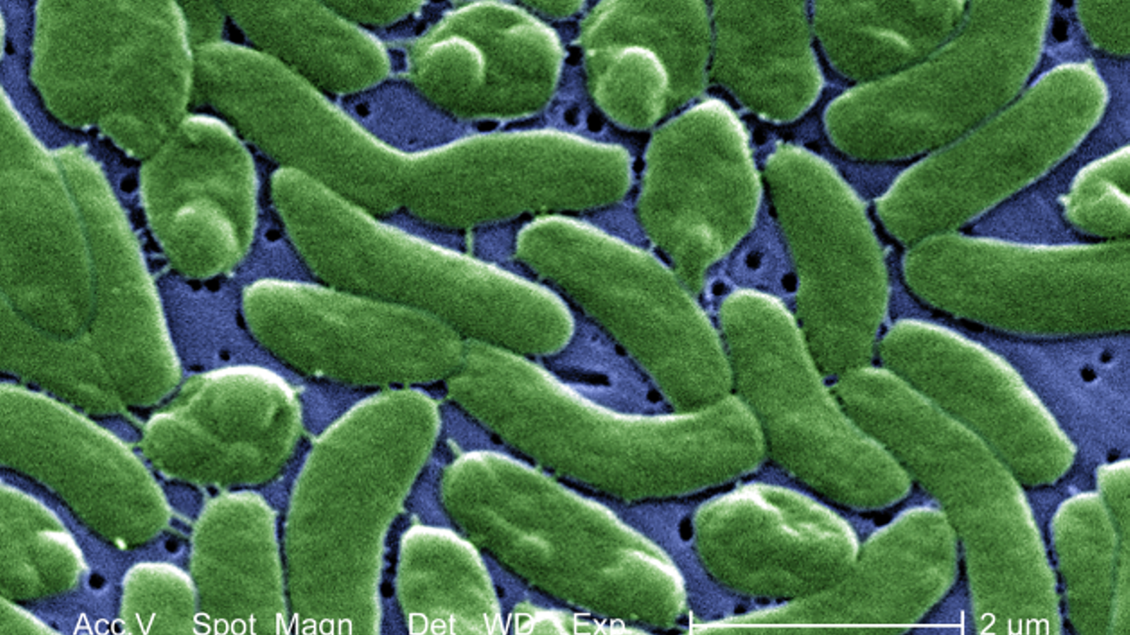 Et Yiyen Bakteri Vibrio vulnificus: ABD'de Can Kayıpları ve Küresel Tehdit